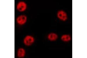 ABIN6275645 staining HepG2 by IF/ICC.