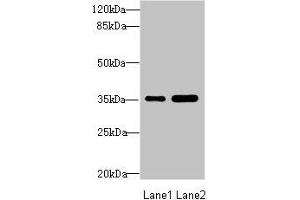 Western blot All lanes: TOB2 antibody at 1. (TOB2 anticorps  (AA 1-70))