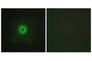 Immunofluorescence analysis of HeLa cells, using TNF Receptor II antibody.