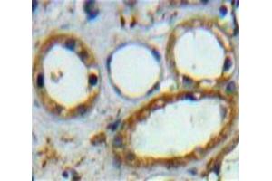 Used in DAB staining on fromalin fixed paraffin-embedded Kidney tissue (CD3D anticorps  (AA 18-113))