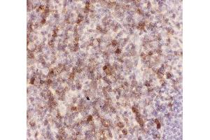IHC-P: CD43 antibody testing of mouse spleen tissue (CD43 anticorps  (AA 272-400))