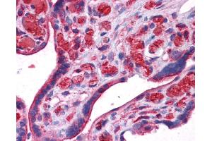 UCHL3 antibody was used for immunohistochemistry at a concentration of 4-8 ug/ml. (UCHL3 anticorps)
