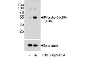 Western blot analysis of extracts from HeLa cells, untreated or treated with Calyculin A, using phospho-Cdc25A antibody.