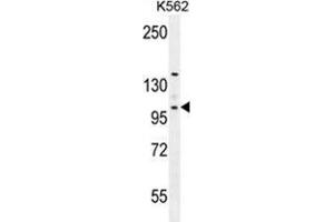 VILL Antibody (Center) western blot analysis in K562 cell line lysates (35 µg/lane). (VILL anticorps  (Middle Region))