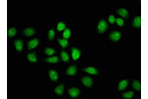 Immunofluorescence staining of Hela cells with ABIN7153843 at 1:133, counter-stained with DAPI. (GANP anticorps  (AA 292-435))