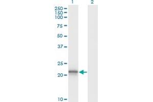 Western Blot analysis of VHL expression in transfected 293T cell line by VHL monoclonal antibody (M01), clone 1G12.