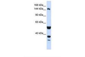 Image no. 1 for anti-ABI Family, Member 3 (NESH) Binding Protein (ABI3BP) (AA 144-193) antibody (ABIN6738309) (ABI3BP anticorps  (AA 144-193))