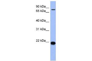 WB Suggested Anti-ZNF800 Antibody Titration:  0. (ZNF800 anticorps  (N-Term))