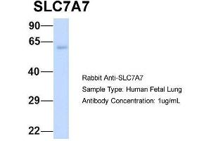 Host:  Rabbit  Target Name:  SLC7A7  Sample Type:  Human Fetal Lung  Antibody Dilution:  1. (SLC7A7 anticorps  (Middle Region))
