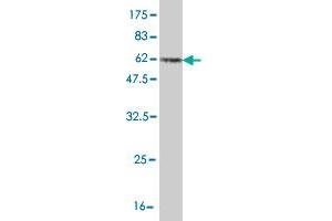 Western Blot detection against Immunogen (54. (PCNA anticorps  (AA 1-261))