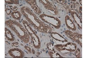 Image no. 2 for anti-Carboxypeptidase A1 (Pancreatic) (CPA1) (AA 1-419) antibody (ABIN1490772) (CPA1 anticorps  (AA 1-419))