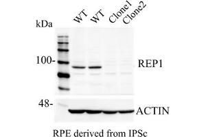 Western Blotting (WB) image for anti-Choroideremia (Rab Escort Protein 1) (CHM) (C-Term) antibody (ABIN6254222) (CHM anticorps  (C-Term))