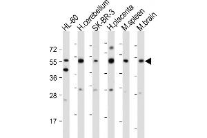 All lanes : Anti-CEPT1 Antibody (N-term) at 1:2000 dilution Lane 1: HL-60 whole cell lysate Lane 2: Human cerebellum tissue lysate Lane 3: SK-BR-3 whole cell lysate Lane 4: Human placenta tissue lysate Lane 5: Mouse spleen tissue lysate Lane 6: Mouse brain tissue lysate Lysates/proteins at 20 μg per lane.