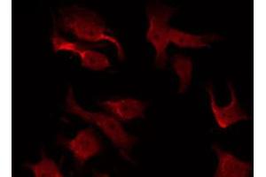 ABIN6267473 staining Hela by IF/ICC. (AKT1 anticorps  (pThr308))