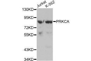 Western blot analysis of extracts of various cell lines, using PRKCA antibody.