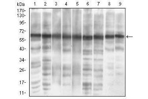 Western blot analysis using EIF2A mouse mAb against MCF-7 (1), PC-12 (2), HepG2 (3), Hela (4), Cos7 (5), K562 (6), Jurkat (7), A431 (8) and NIH/3T3 (9) cell lysate. (EIF2A anticorps  (AA 448-576))