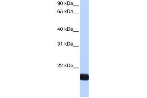 WB Suggested Anti-CTF1 Antibody Titration: 0. (Cardiotrophin 1 anticorps  (N-Term))