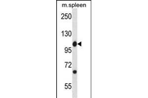 Mouse Abl1 Antibody (Center) (ABIN657828 and ABIN2846795) western blot analysis in mouse spleen tissue lysates (35 μg/lane). (ABL1 anticorps  (AA 613-641))