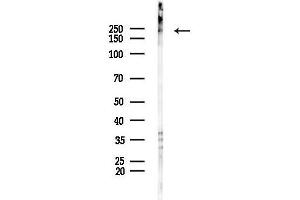 anti-Myosin Heavy Chain 3, Skeletal Muscle, Embryonic (MYH3) (C-Term) antibody