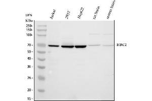 Western blot analysis of cIAP1/BIRC2 using anti-cIAP1/BIRC2 antibody (ABIN5693185).