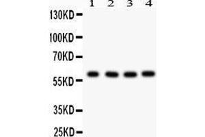 Western Blotting (WB) image for anti-Parafibromin (CDC73) (AA 119-520) antibody (ABIN3043535)