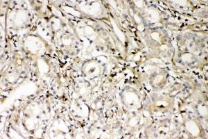 IHC analysis of S100A4 using anti-S100A4 antibody (ABIN7600462). (s100a4 anticorps  (AA 2-101))