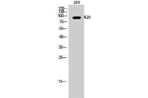 Western Blotting (WB) image for anti-Immunoglobulin kappa Variable 1-27 (IGKV1-27) (Internal Region) antibody (ABIN3183105)