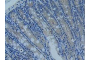 Detection of MMP14 in Mouse Intestine Tissue using Polyclonal Antibody to Matrix Metalloproteinase 14 (MMP14)