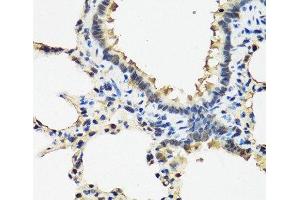 Immunohistochemistry of paraffin-embedded Rat lung using ARSF Polyclonal Antibody at dilution of 1:100 (40x lens). (ARSF anticorps)