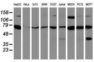 Image no. 4 for anti-Sec1 Family Domain Containing 1 (SCFD1) antibody (ABIN1500819)