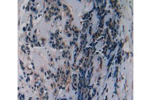 Used in DAB staining on fromalin fixed paraffin- embedded breast cancer tissue (SLURP1 anticorps  (AA 1-103))