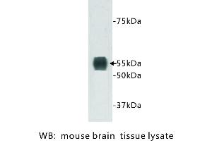 Image no. 1 for anti-Transmembrane Protein 132A (TMEM132A) antibody (ABIN1112938)