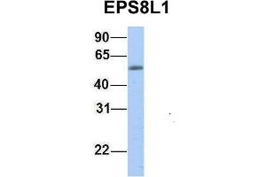 Host:  Rabbit  Target Name:  EPS8L1  Sample Type:  Human Fetal Muscle  Antibody Dilution:  1.
