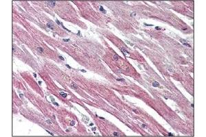 Immunohistochemistry: EPHX2 antibody staining of Formalin-Fixed, Paraffin-Embedded Human Heart. (EPHX2 anticorps  (C-Term))