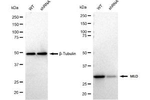 Western blotting analysis using MLD antibody (ABIN7799509).