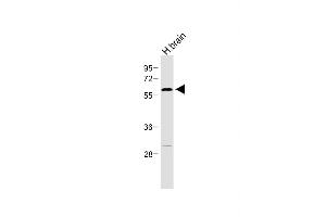 Anti-RORA Antibody  at 1:500 dilution + Human brain lysate Lysates/proteins at 20 μg per lane.