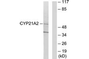 Western blot analysis of extracts from 293 cells, using Cytochrome P450 21A2 Antibody.