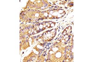 (ABIN6242230 and ABIN6577881) staining Epcam in Mouse colon tissue sections by Immunohistochemistry (IHC-P - paraformaldehyde-fixed, paraffin-embedded sections).