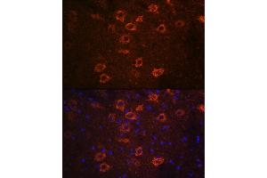 Immunofluorescence analysis of mouse brain using SLC18 Rabbit pAb (ABIN7270410) at dilution of 1:100 (40x lens).