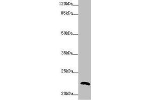 Western blot All lanes: PPIF antibody at 5. (PPIF anticorps  (AA 30-207))