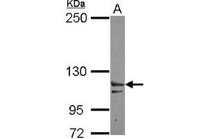 Exportin 6 anticorps  (AA 135-383)