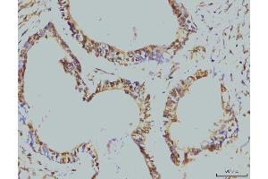 IHC analysis of RPA32/RPA2 using anti-RPA32/RPA2 antibody (ABIN7601379). (RPA2 anticorps  (AA 34-254))