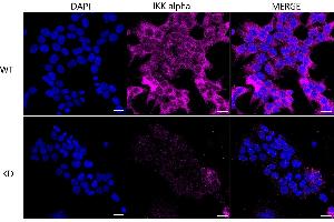 Immunocytochemical staining of HeLa cells using IKK alpha antibody (ABIN7798147), 1:1,000), Top panel: wild-type (WT), Bottom panal: IKK alpha shRNA knockdown (KD).