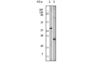 Western blot analysis using ApoM antibody against GST-ApoM recombinant protein (1) and human serum (2). (Apolipoprotein M anticorps)
