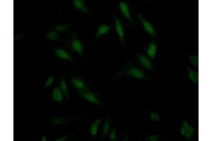Immunofluorescence staining of Hela Cells with ABIN7127796 at 1:50, counter-stained with DAPI.