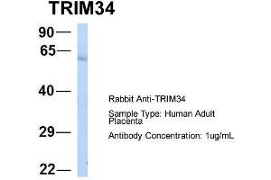 Host:  Rabbit  Target Name:  TRIM34  Sample Type:  Human Adult Placenta  Antibody Dilution:  1. (TRIM34 anticorps  (N-Term))