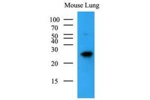Mouse lung lysates (35 ug) were resolved by SDS-PAGE, transferred to nitrocellulose membrane and probed with anti-human BAK1 (1:500). (BAK1 anticorps  (AA 29-187))
