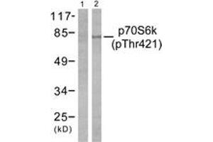 Western blot analysis of extracts from NIH-3T3 cells treated with EGF 200ng/ml 30', using p70 S6 Kinase (Phospho-Thr421) Antibody. (RPS6KB1 anticorps  (pThr444))