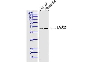 Lane 1: jurkat lysates Lane 2: mouse placenta lysates probed with EVX2 Polyclonal Antibody, Unconjugated  at 1:300 dilution and 4˚C overnight incubation. (EVX2 anticorps  (AA 1-100))