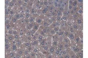 Detection of ZRF1 in Mouse Liver Tissue using Polyclonal Antibody to Zuotin Related Factor 1 (ZRF1)